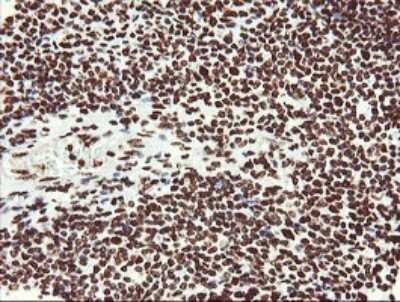 Immunohistochemistry: NONO Antibody (OTI3F8) [NBP2-46194]