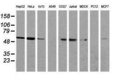 Western Blot: NONO Antibody (OTI3F8) [NBP2-46194]