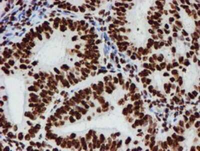 Immunohistochemistry: NONO Antibody (OTI4D9) - Azide and BSA Free [NBP2-73034]