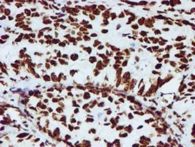 Immunohistochemistry: NONO Antibody (OTI4D9) - Azide and BSA Free [NBP2-73034]