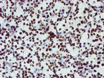 Immunohistochemistry: NONO Antibody (OTI4D9) - Azide and BSA Free [NBP2-73034]