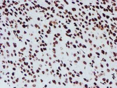 Immunohistochemistry: NONO Antibody (OTI4D9) - Azide and BSA Free [NBP2-73034]