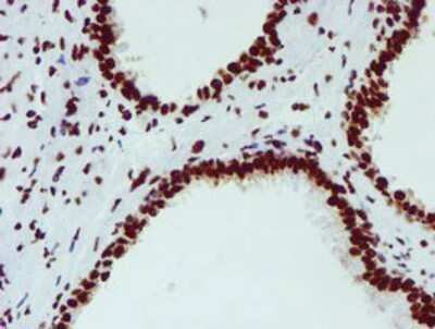 Immunohistochemistry: NONO Antibody (OTI4D9) - Azide and BSA Free [NBP2-73034]