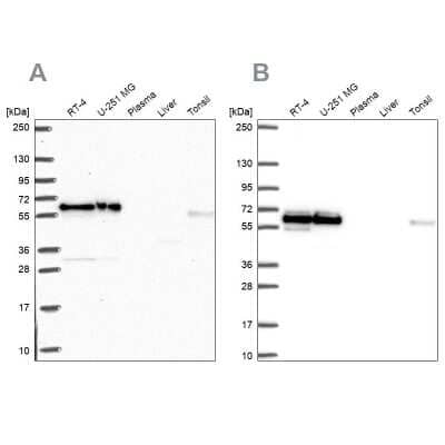 Western Blot: NONO Antibody [NBP2-38716]