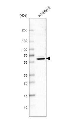 Western Blot: NONO Antibody [NBP2-38727]