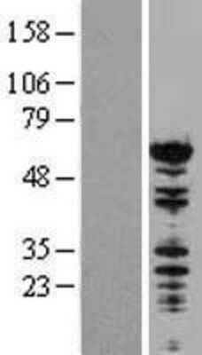 Western Blot: NONO Overexpression Lysate [NBP2-09747]