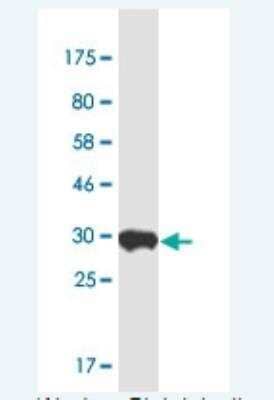 Western Blot: NOP10 Antibody (6H6) [H00055505-M01-100ug]