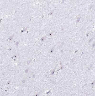 Immunohistochemistry-Paraffin: NOP10 Antibody [NBP2-32441]