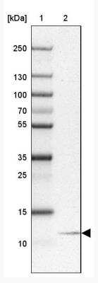 Western Blot: NOP10 Antibody [NBP2-32441]