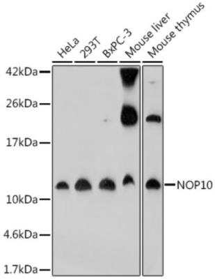 Western Blot: NOP10 AntibodyAzide and BSA Free [NBP2-93614]