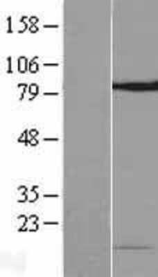 Western Blot: NOP10 Overexpression Lysate [NBP2-06780]