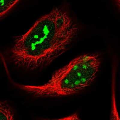 Immunocytochemistry/ Immunofluorescence: NOP14 Antibody [NBP2-13665]