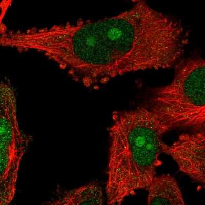 Immunocytochemistry/ Immunofluorescence: NOP14 Antibody [NBP2-55807]