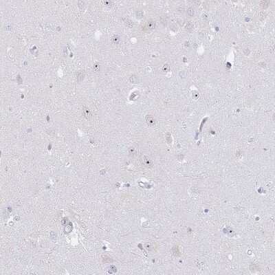 Immunohistochemistry-Paraffin: NOP14 Antibody [NBP2-13665]