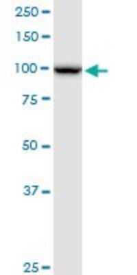 Western Blot: NOP14 Antibody [H00008602-B01P]