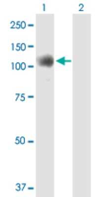 Western Blot: NOP14 Antibody [H00008602-B01P]