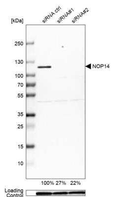 Western Blot: NOP14 Antibody [NBP2-13665]