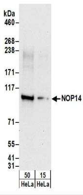 Western Blot: NOP14 Antibody [NBP2-22226]