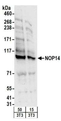 Western Blot: NOP14 Antibody [NBP2-22227]