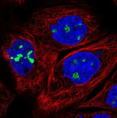 Immunocytochemistry/ Immunofluorescence: NOP56 Antibody (CL2603) [NBP2-36778]