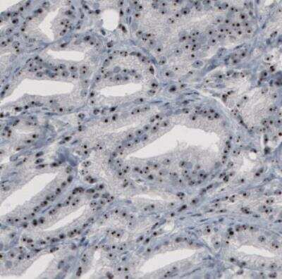 Immunohistochemistry: NOP56 Antibody (CL2603) [NBP2-36778]