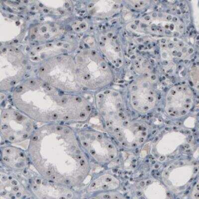 Immunohistochemistry: NOP56 Antibody (CL2603) [NBP2-36778]