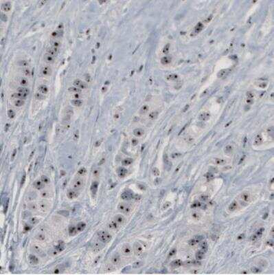 Immunohistochemistry: NOP56 Antibody (CL2603) [NBP2-36778]