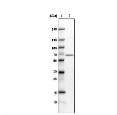 Western Blot: NOP56 Antibody (CL2603) [NBP2-36778]