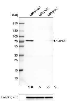 Western Blot: NOP56 Antibody (CL2603) [NBP2-36778]