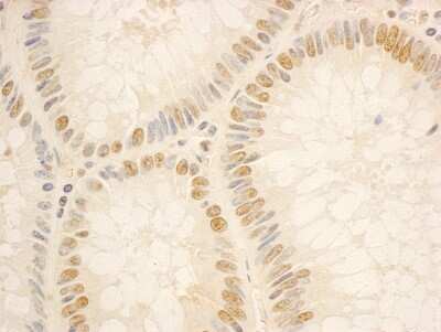 Immunohistochemistry: NOP56 Antibody [NBP1-46848]