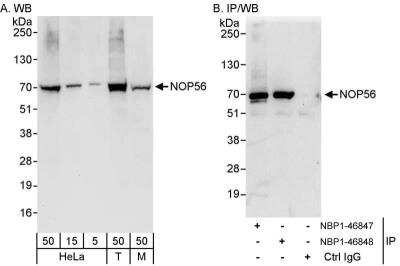 Western Blot: NOP56 Antibody [NBP1-46847]