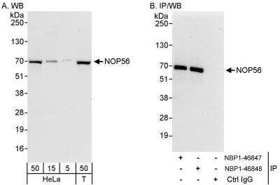 Western Blot: NOP56 Antibody [NBP1-46848]