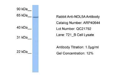 Western Blot: NOP56 Antibody [NBP1-57358]