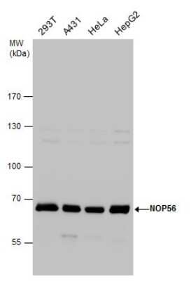 Western Blot: NOP56 Antibody [NBP3-12977]