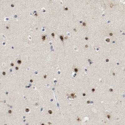 Immunohistochemistry-Paraffin: NOP58 Antibody [NBP1-81680]