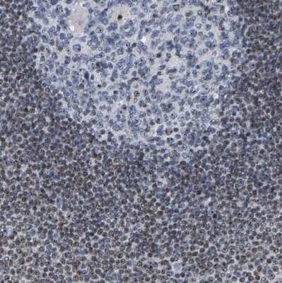 Immunohistochemistry-Paraffin: NOP58 Antibody [NBP1-81680]