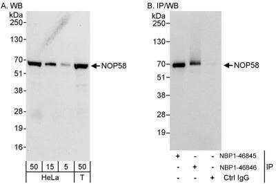 Immunoprecipitation: NOP58 Antibody [NBP1-46846]
