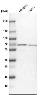 Western Blot: NOP58 Antibody [NBP1-81680]