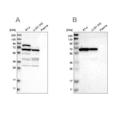 Western Blot: NOP58 Antibody [NBP1-81680]