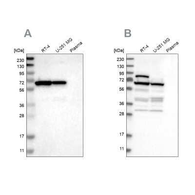 Western Blot: NOP58 Antibody [NBP1-81681]