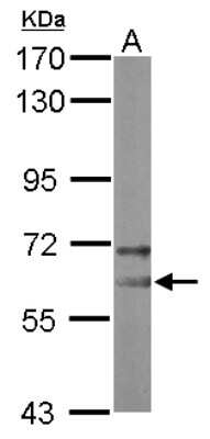 Western Blot: NOP58 Antibody [NBP2-19564]