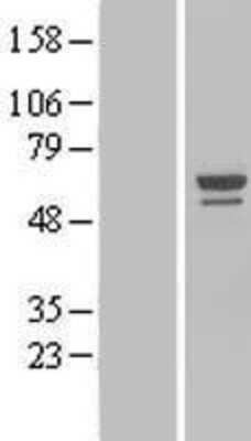 Western Blot: NOP58 Overexpression Lysate [NBL1-13718]