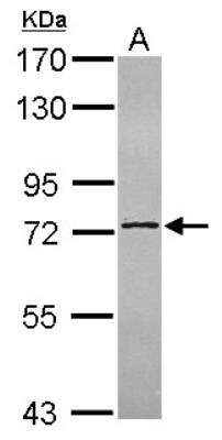 Western Blot: NOP9 Antibody [NBP2-15634]