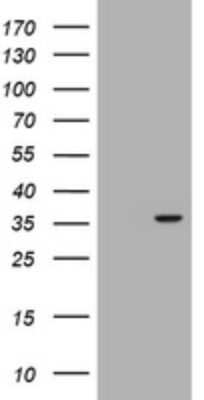 Western Blot: NORE1 Antibody (OTI1C6) [NBP2-45529]