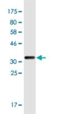 Western Blot: NORE1 Antibody (5C2) [H00083593-M01]