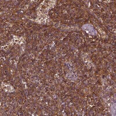 Immunohistochemistry-Paraffin: NORE1 Antibody [NBP2-57516]