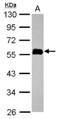 Western Blot: NORE1 Antibody [NBP2-19565]