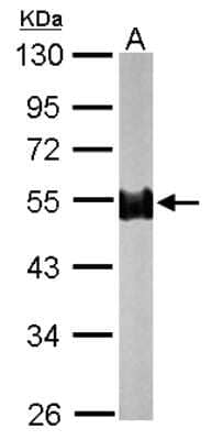 Western Blot: NORE1 Antibody [NBP2-19565]