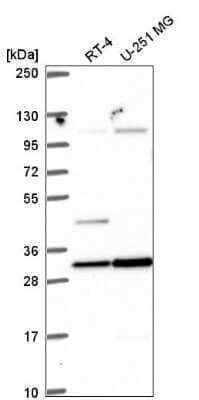 Western Blot: NORE1 Antibody [NBP2-57516]