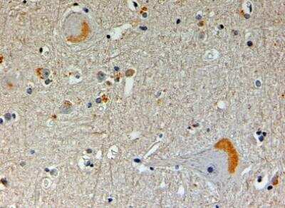 Immunohistochemistry-Paraffin: NOS1AP Antibody [NB100-1090]